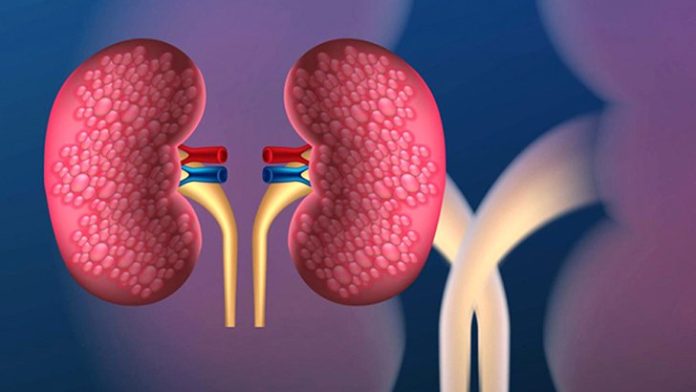 চট্টগ্রামে এবার একটি কিডনি হাসপাতাল হোক